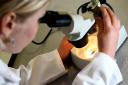 Fewer women in Oxfordshire completed screenings for cervical cancer.