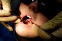 The British Dental Association has warned NHS dentistry is on the brink of collapse